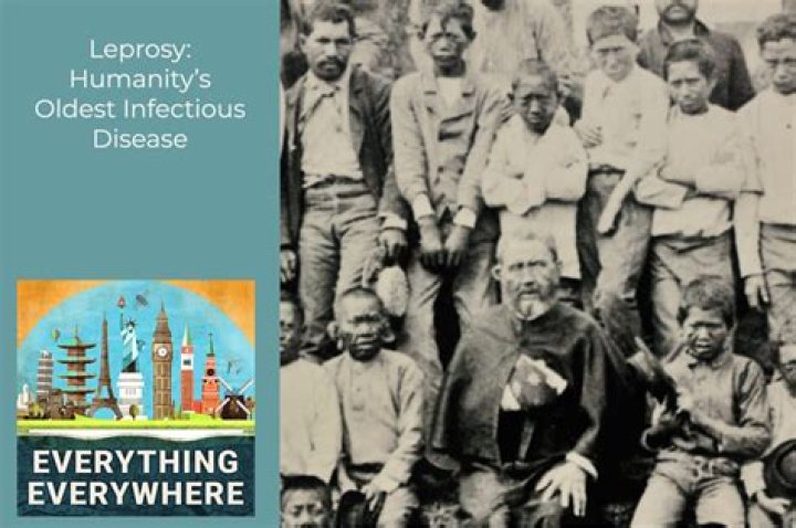 A Brief History Of Leprosy, The Oldest Human Disease