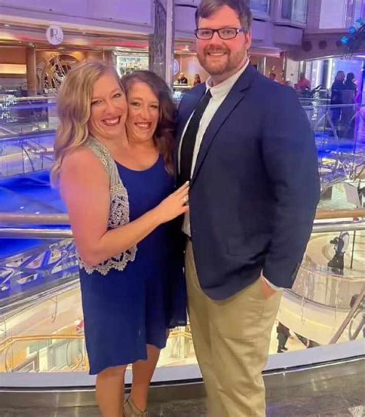 ¿Abby y Brittany se operaron para separarse? – Celebrity.fm