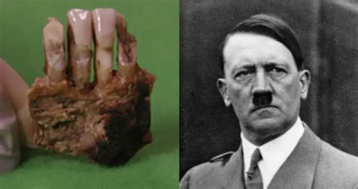 Disease-Ridden Teeth Belonged To Hitler, Scientists Confirm