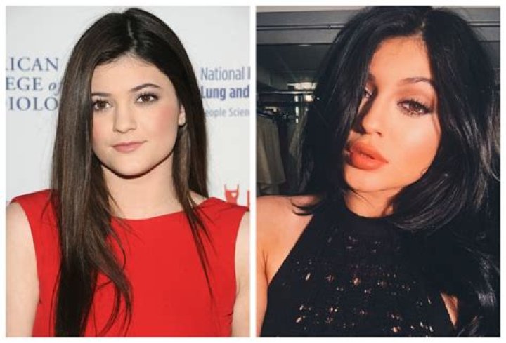 People Are Trying the “Kylie Jenner Challenge” for Bigger Lips — and the Results Are Horrifying